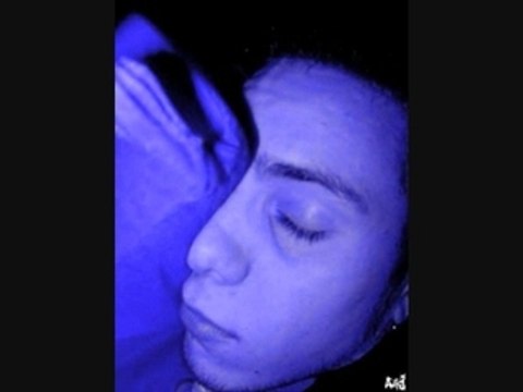 X RAY DOG HERMES THE KING