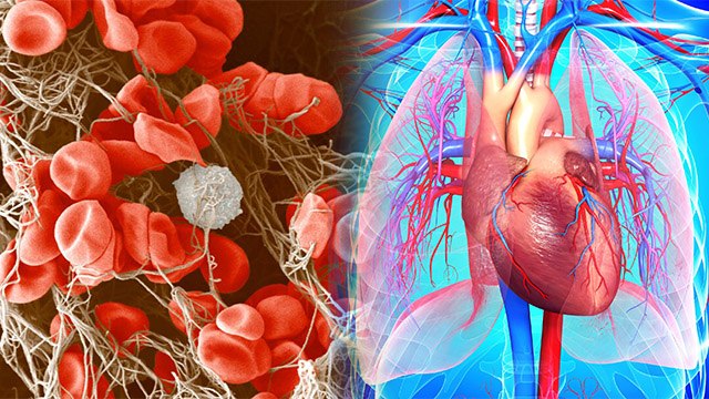 Blood को गंदा कर देती हैं खाने की ये चीजें, कभी भी आ सकता है Heart Attack ! Boldsky