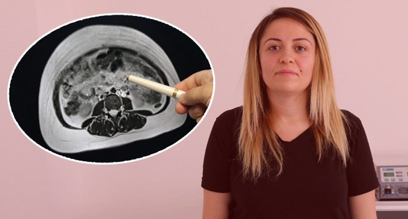Yıllardır hamile gibi yaşıyordu: Doktora gidince gerçeği öğrendi