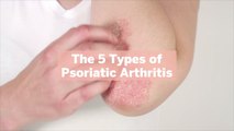 The 5 Types of Psoriatic Arthritis—And the Common Symptoms Associated With Each