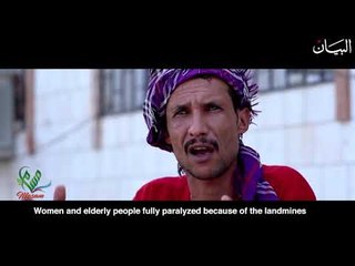 صرخة يمني في وجه غدر الحوثي