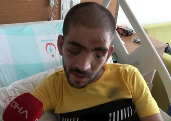 GEÇİRDİĞİ KAZA SONUCU DÜNYASI KARARDI, TEK İSTEĞİ KIZINI GÖREBİLMEK