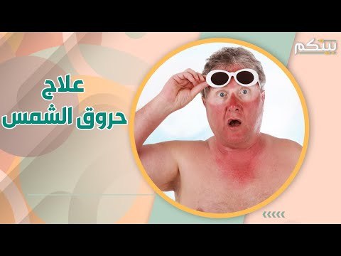 تصاب عائلتك بحروق الشمس في الصيف ؟ اليك سبل الوقاية و العلاج طبيعيا ..