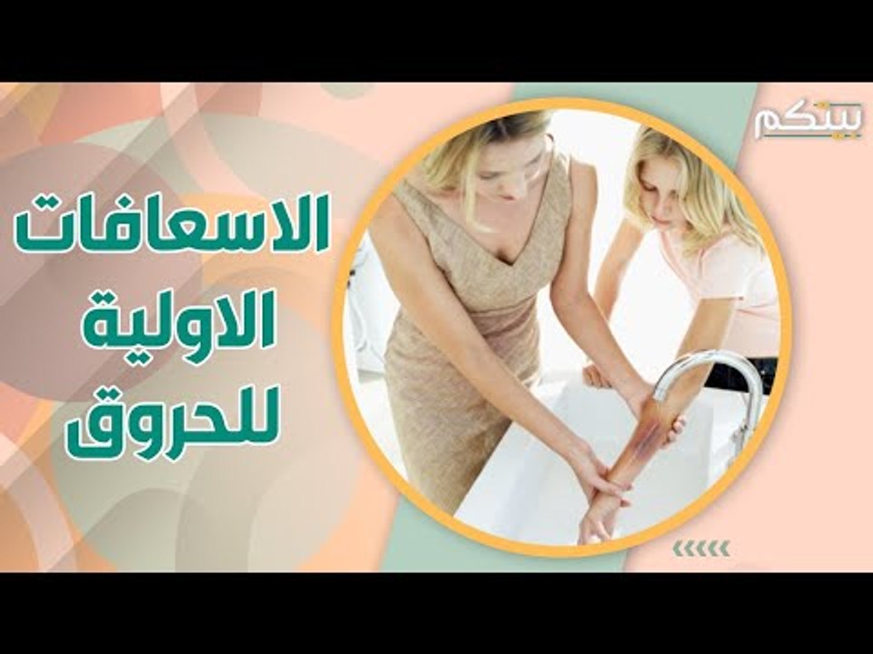 الاجراءات الاولية للتعامل مع الحروق بحسب درجاتها .. ريثما تصل سيارة الاسعاف !