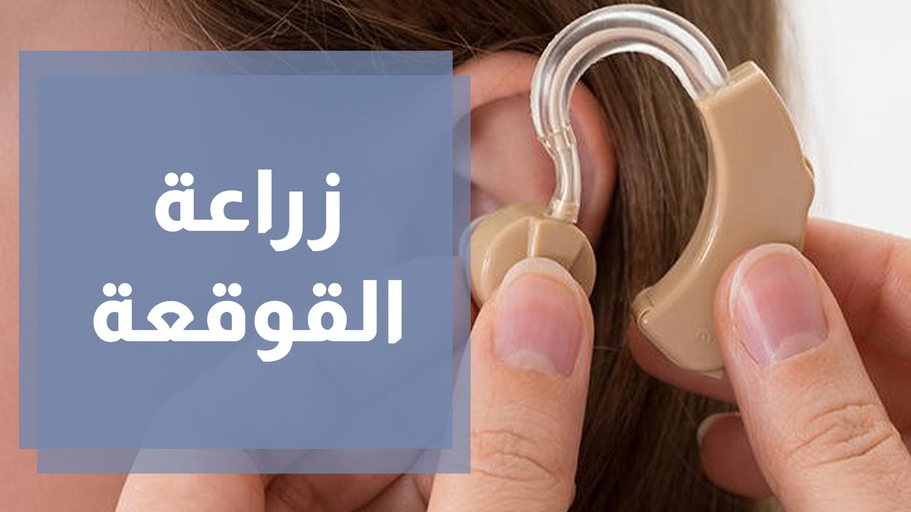 كيفية تأهيل الأطفال بعد زراعة القوقعة