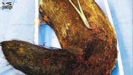 আপনার শরীরের ভিতরেও এই ভয়ংকর প্রাণীগুলো থাকতে পারে। 10 Shocking Creatures Found