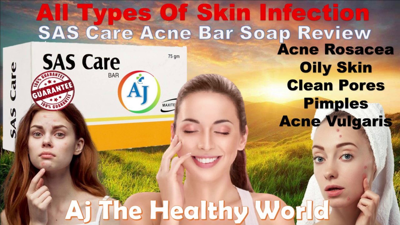 Best Acne Bar Review | SAS Care Acne Bar | Oily Skin | Sulfur Bar | Salicylic Acid Bar | Anti-Acne Bar