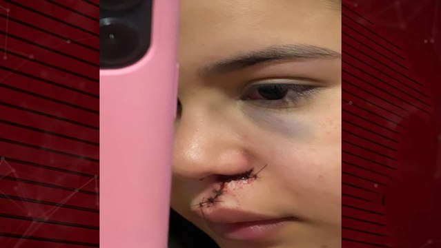 Adolescente de Cajazeiras rejeita convite de dança de homem e é agredida com garrafada