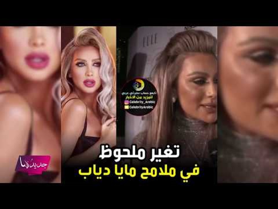 تشوّه وجه مايا دياب بسبب عمليات التجميل! لن تصدقوا شكلها