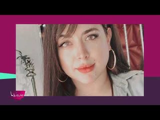 تشوه وجه هيا مرعشلي بالفيلر وجديدها تكشف الحقيقة !!