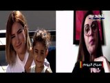 يارا ... اصغر طفلة مصابة بحادثة مرفأ بيروت تروي ما حصل معها