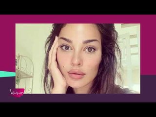 نادين نجيم تنصح بطبيب تجميل جديد!! من هو؟ وصور حصرية لآخر لحظاتها قبل حادثة بيروت