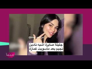 Download Video: ممثلة مشهورة تخضع لعملية تصغير ثدي لتشبه نادين نسيب نجيم! النتيجة صادمة!