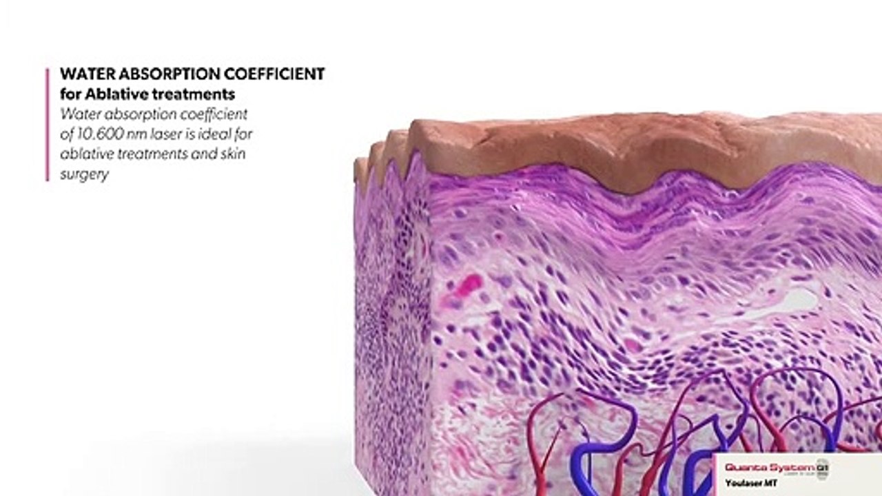 Ablative Skin Resurfacing Bodyvie