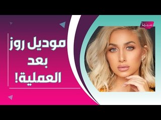 اول ظهور لـ مودل روز بعد عملية قص الجفون التجميلية !! لن تصدقوا كيف اصبح شكلها