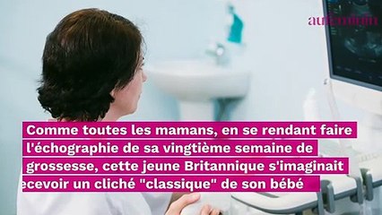 "C'est assez rare" : effrayée, cette maman découvre une échographie pas comme les autres