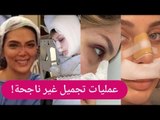 افشل عمليات تجميل بينهنّ ابنة هيفاء وهبي و حورية فرغلي و الدكتورة خلود : زرعت راس جديد!!