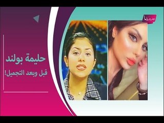خاص – حليمة بولند تكشف عن عمليات تجميل جسمها .. وخطوة غير متوقعة على الهواء !!
