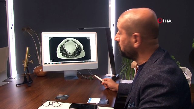 Yıllardır karnı şiş geziyordu, doktora gidince gerçeği öğrendi