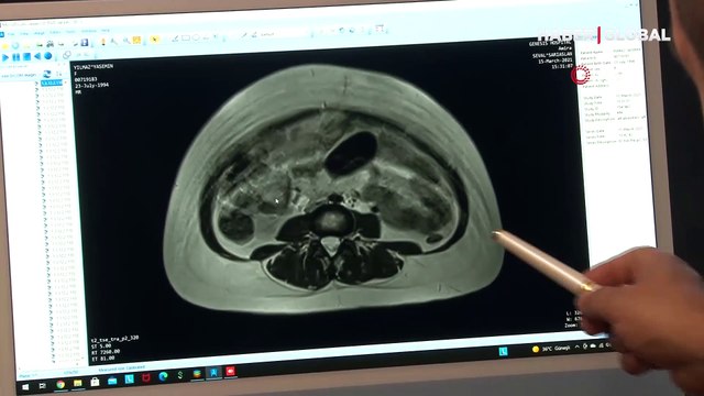 Yıllardır hamile gibi yaşıyordu, doktora gidince gerçek ortaya çıktı