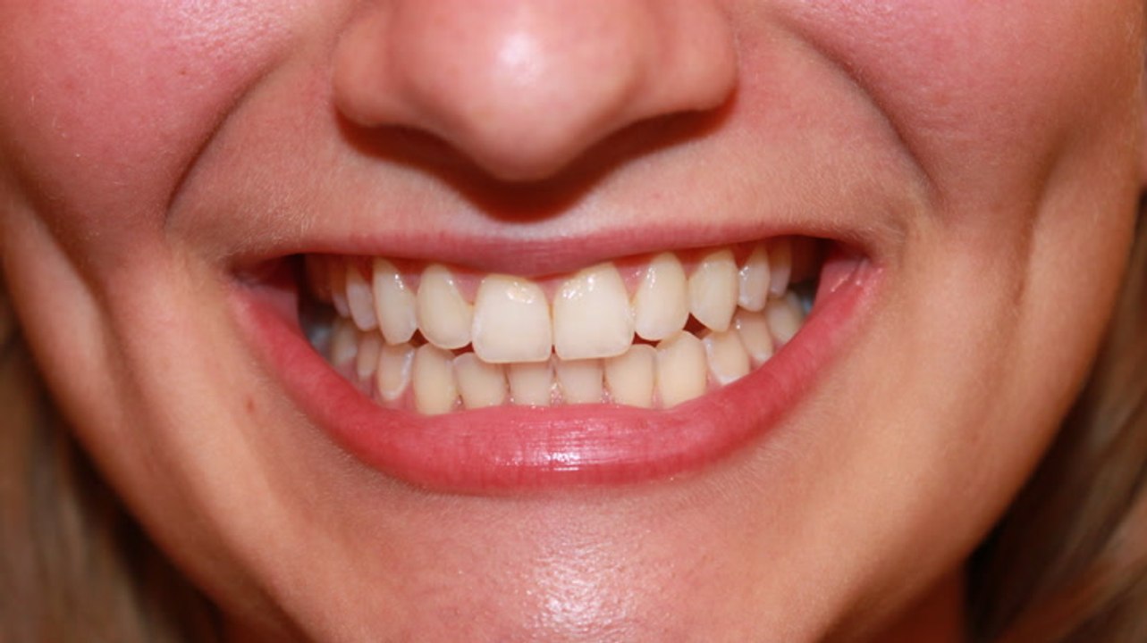 Why humans can't regrow teeth