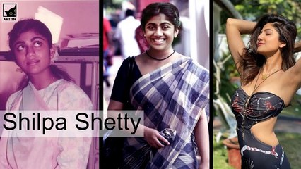 Bollywood-Prominente vor und nach angeblicher plastischer Chirurgie