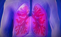 Akciğer kanderi belirtileri nelerdir? Akciğer kanseri nedir?