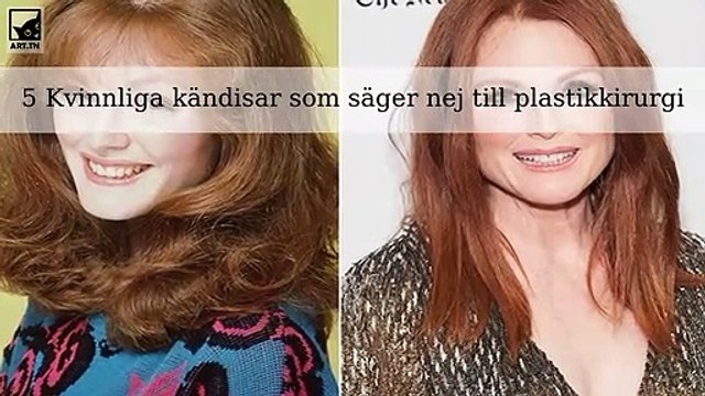 5 Kvinnliga kändisar som säger nej till plastikkirurgi