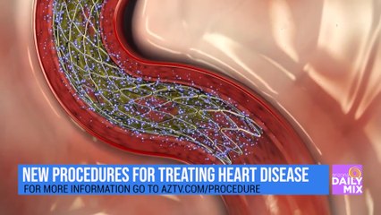 Let’s Talk Heart Health and the Next Procedure with Dr. Rizik