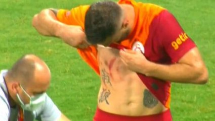 "Savaş izleri gururum" diyen Alpaslan Öztürk, G.Saray taraftarının kalbini fethetti