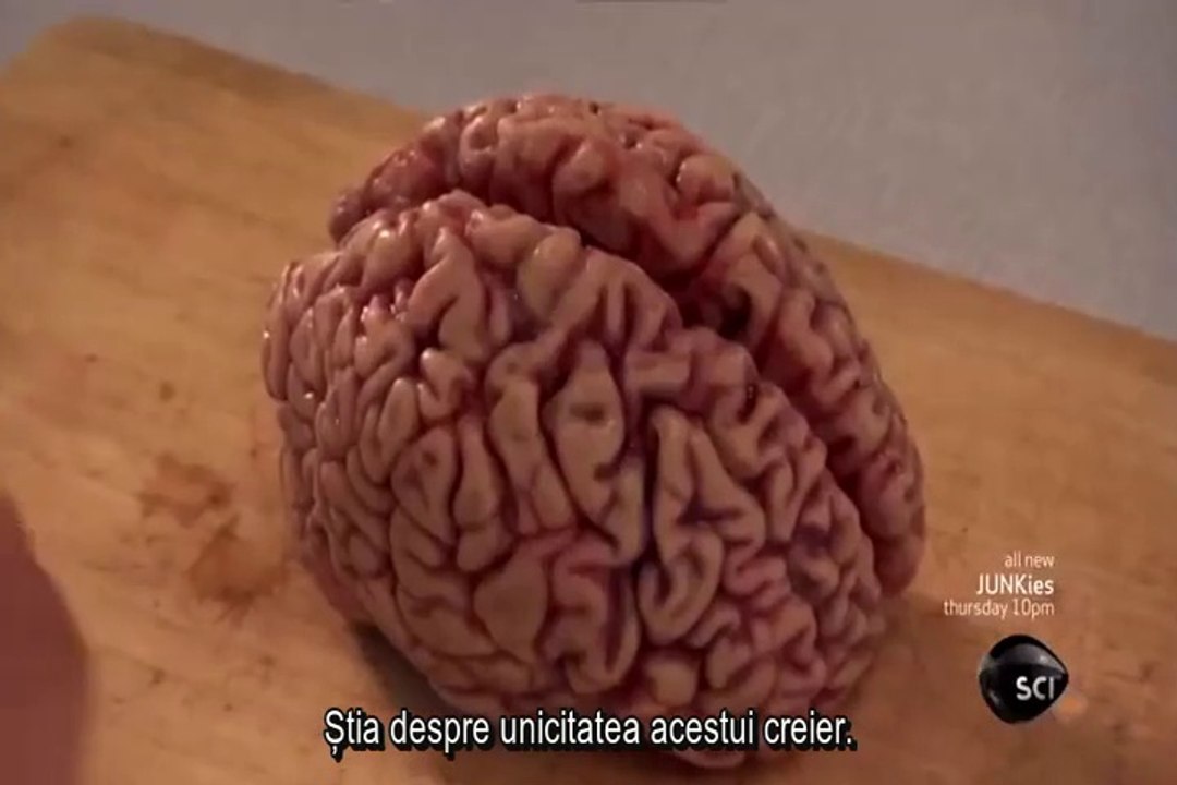 I have Einstein's brain