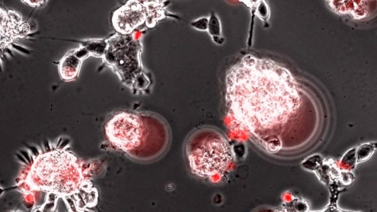 Voici les effets dévastateurs du SARS-CoV-2 sur des cellules de chauves-souris