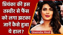 Priyanka Chopra फिल्म Citadel की Shooting के दौरान घायल, लगी गंभीर चोट | वनइंडिया हिंदी