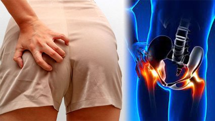 Hips में दर्द Dead Butt Syndrome का Symptom, Body पर खतरनाक Effect | Boldsky