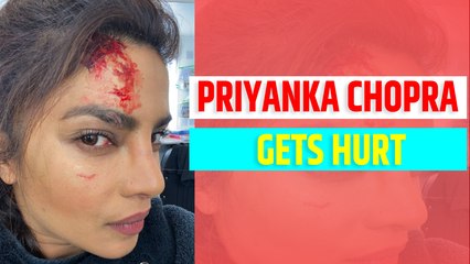 Priyanka Chopra injured on the set of 'Citadel'