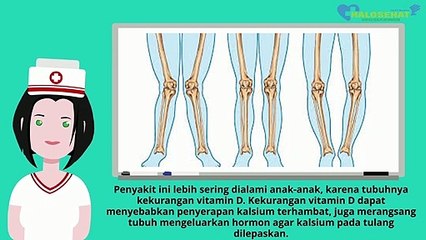 Ketahui 5 Jenis Penyakit Tulang yang Sering Terjadi