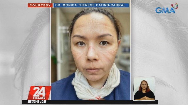 Mga bakas mula sa ilang oras na pagsusuot ng PPE, tanda ng paghihirap ng health workers ngayong pandemya | 24 Oras