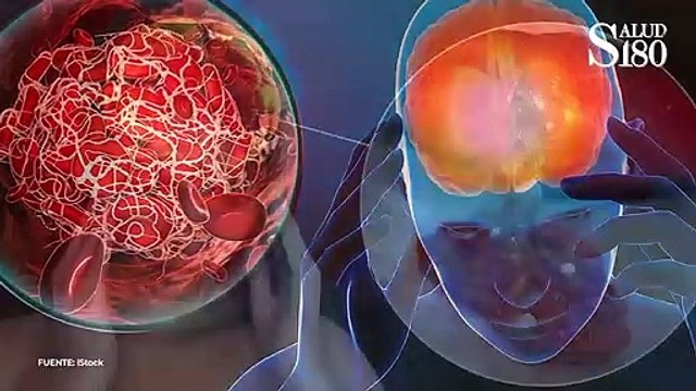 3 padecimientos que elevan tus triglicéridos | Salud180