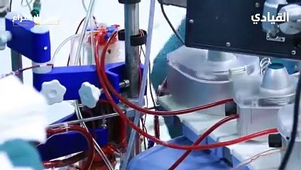 تاريخ اختراع القلب الصناعي وكيف تمت عملية زراعة أول قلب خارجي؟