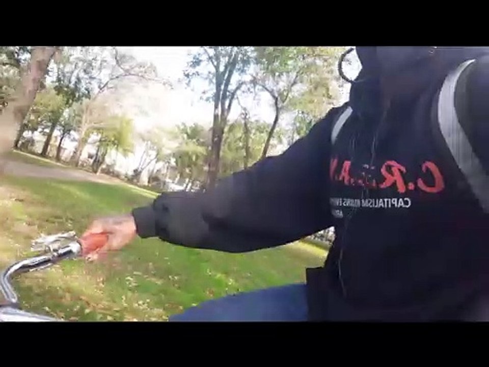 my amputation journey.