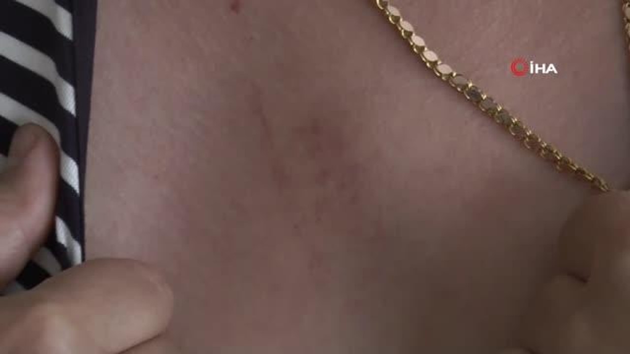 Eski erkek arkadaş dehşeti...Darp edilip seyir halindeki araçtan atılan kadın konuştu