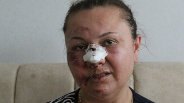 Eski erkek arkadaş dehşeti! Hareket halindeki araçtan atıldı