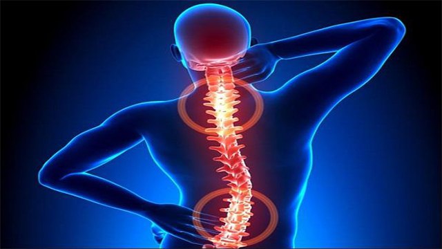 Spinal Tb क्यों होता है । रीढ़ की हड्डी में टीबी के लक्षण और उपाय। Spinal Tuberculosis। Boldsky