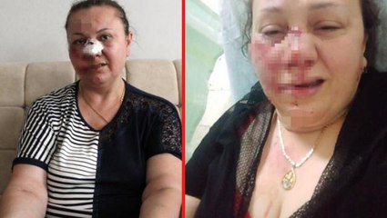 Eski erkek arkadaşı tarafından kaçırılan kadın acımasızca darbedildikten sonra hastane önüne atıldı