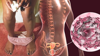 Periods के दौरान वेजाइना में खुजली क्यों होती है, Doctors Advice | Boldsky