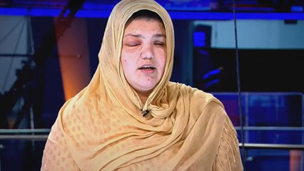 Khatera Hashmi shares her eyes were gouged by Taliban