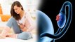 Females में Ovarian Cancer Symptoms चौंक देंगे | Ovarian Cancer Symptoms | Boldsky