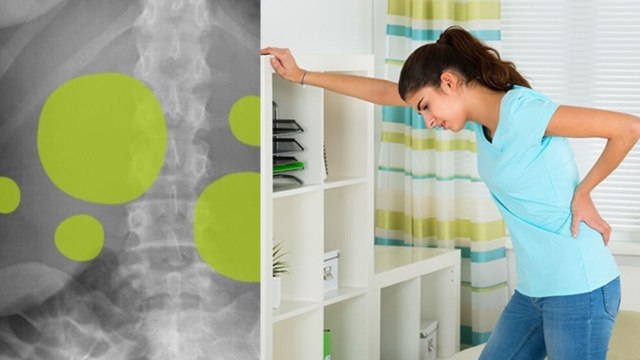 गैस से पीठ में दर्द क्यों होता है | Gas Se Pith Dard Ka Ilaj | Boldsky