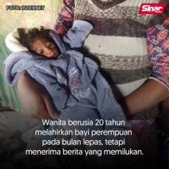 Gempar ibu muda lahir bayi berwajah tua