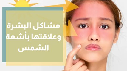 مشاكل البشرة الأساسية وعلاقتها بأشعة الشمس